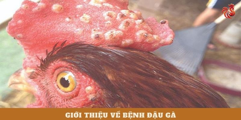 bệnh đậu gà có lây sang người không